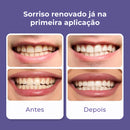 Violux - Fita de Clareamento Roxa Que Elimina o Amarelado e Clareia os Dentes Desde a Primeira Sessão