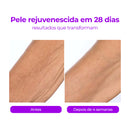 Liftêra – Creme Firmador com Extrato de Champagne Que Rejuvenesce a Pele Visivelmente em 28 Dias